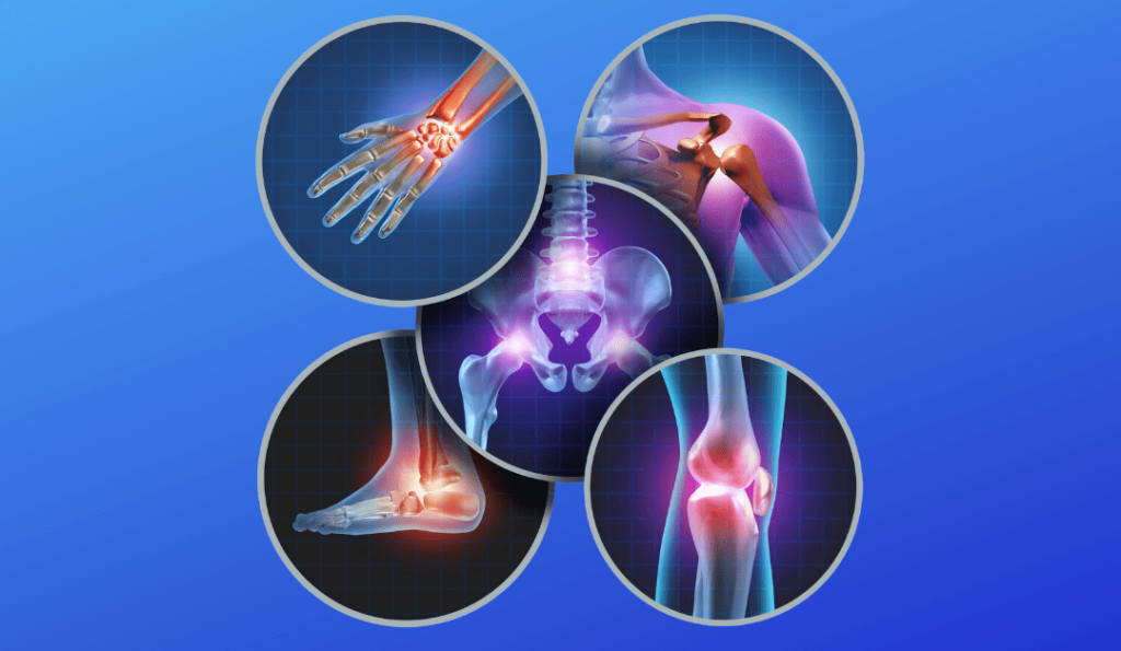Orthopedics